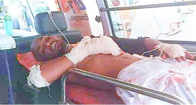 পূর্ব শত্রুতার জেরে যুবকের রগ কাটল প্রতিপক্ষ