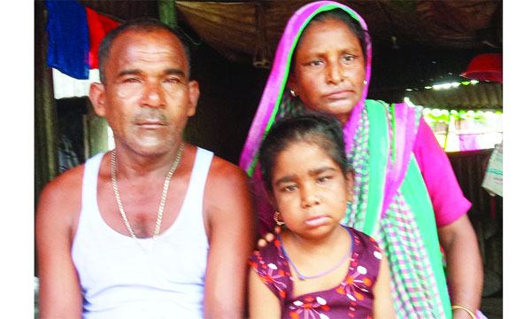 ২২ বছরেও হাঁটাচলা করতে পারে না  রিপা