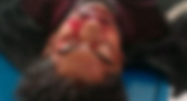 রাজবাড়ীতে পৃথক দুর্ঘটনায় ২ মোটরসাইকেল আরোহী নিহত
