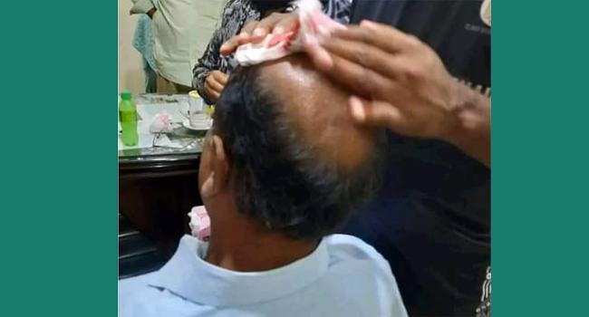 খেলাকে কেন্দ্র করে মাথা ফাটলো রাবি প্রক্টরের