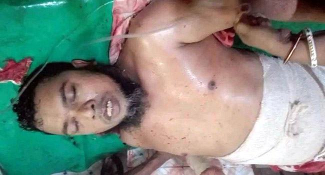 মঠবাড়িয়ায় দুর্বৃত্তদের কোপে জাপা নেতার পা বিচ্ছিন্ন