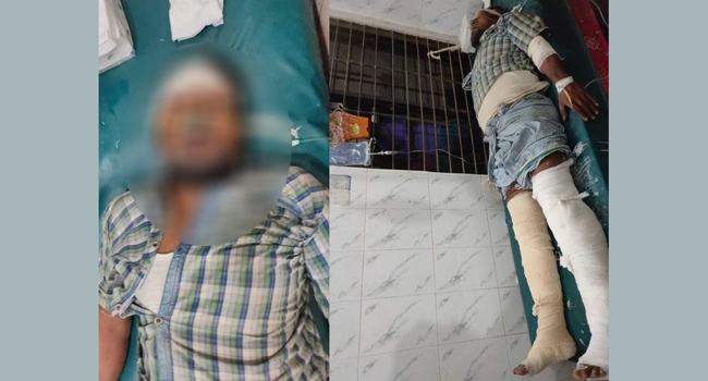এম‌পি মাসুদ চৌধুরীর বহ‌রের গাড়িচাপায় দুই পা ভাঙল রিকশাচালকের