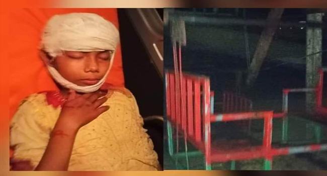 ঈদগাঁওতে নাগরদোলায় পেঁচিয়ে খুলির চামড়া উপড়ে গেল শিশুর