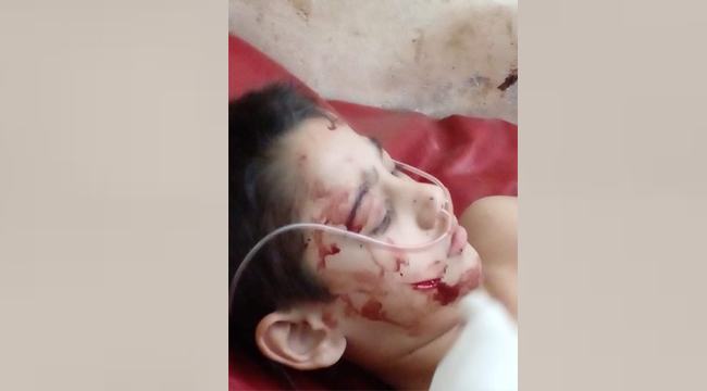 নোয়াখালীতে নারীর বিরুদ্ধে ৫ শিশুকে কুপিয়ে হত্যা চেষ্টার অভিযোগ