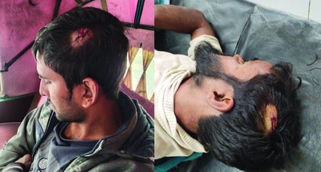 সাঁথিয়ায় জমিজমা বিরোধে মহিলাসহ আহত ৫