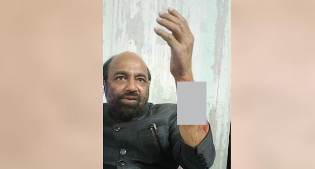 গৌরীপু‌রে বিএনপির মিছিলে আওয়ামী লীগের হামলা, আহত ১৫