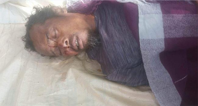 বাকেরগঞ্জে বিদ্যুৎস্পৃষ্ট হয়ে বাকপ্রতিবন্ধীর মৃত্যু