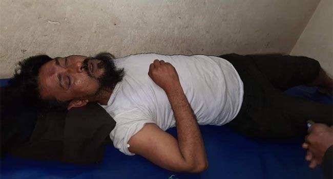 ঈশ্বরগঞ্জে নারী ইউপি সদস্যের পর মারধরের শিকার হলেন পুরুষ সদস্য