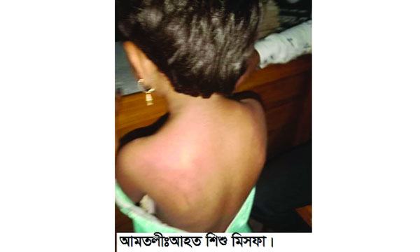 তালতলীতে দুষ্টুমী করায় প্রথম শ্রেণীর ছাত্রীকে অমানুষিক নির্যাতন