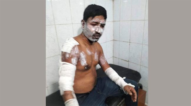 সোনারগাঁওয়ে গ্যাস লিকেজ থেকে আগুন, দগ্ধ হয়ে আহত ৪