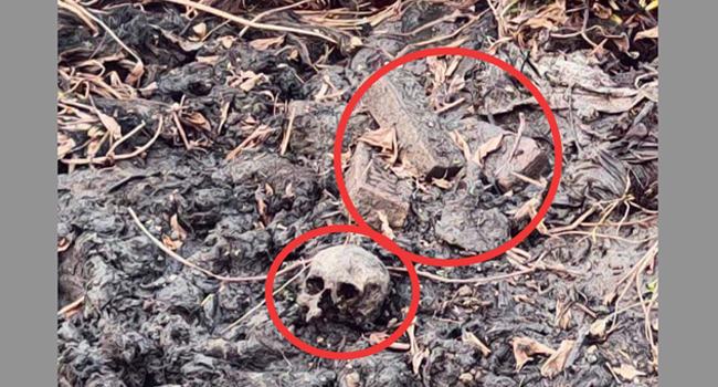 রামগঞ্জে মানুষের মাথার খুলি ও হাড়গোড়ের সন্ধান