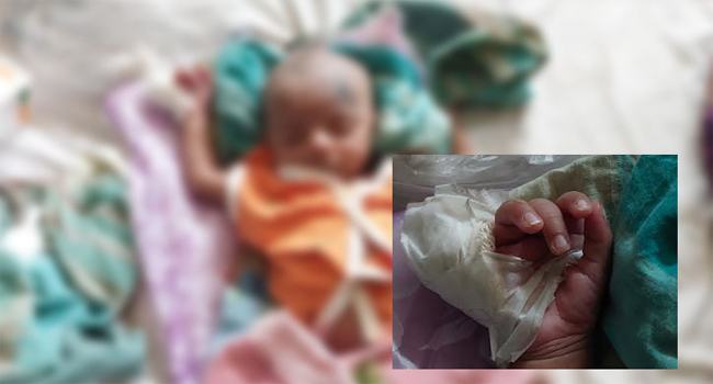 পাবনায় ক্যানোলা খুলতে গিয়ে নবজাতকের আঙ্গুল কেটে ফেললেন আয়া