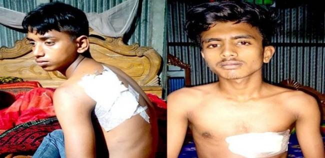সোনারগাঁওয়ে ২ জনকে কুপিয়ে জখম