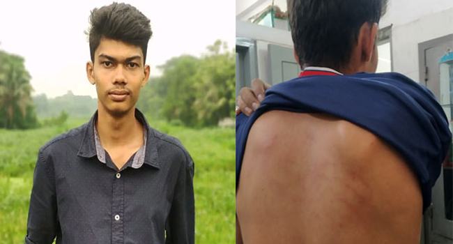 পলাশে সাংবাদিককে ডেকে এনে পেটালেন কাউন্সিলর
