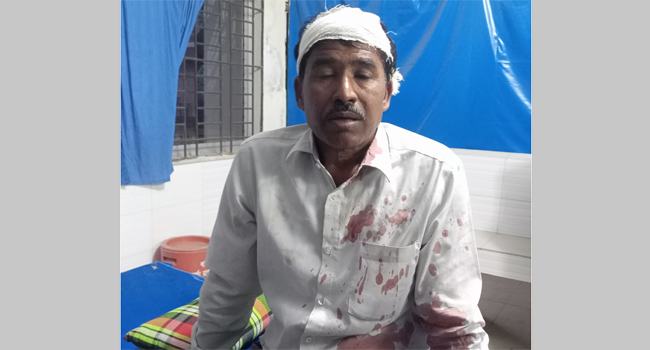 ভিজিডি কার্ডের টাকা না দেয়ায় মাথা ফাটালেন ইউপি সদস্য