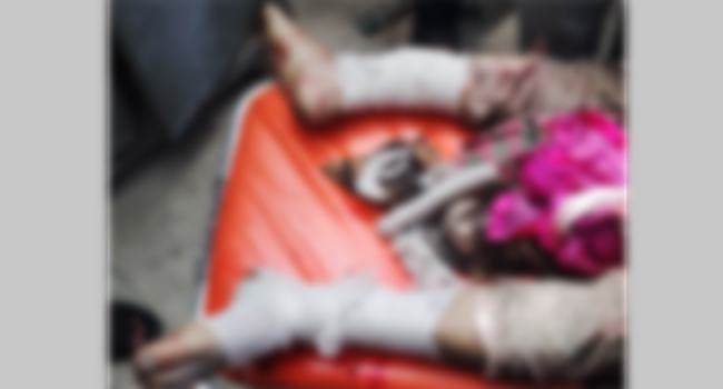 বেতাগীতে যুবলীগ নেতার পা বিচ্ছিন্ন করলেন ছাত্রলীগ নেতা