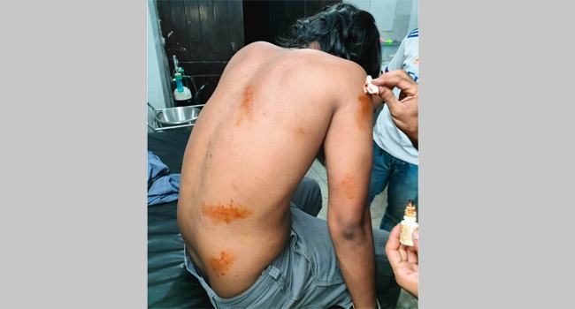 বহিরাগত দ্বারা ইবি শিক্ষার্থীকে মারধরের অভিযোগ