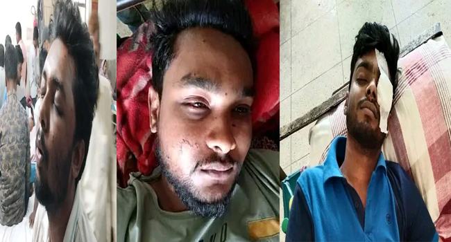 আশ্বাসের পরও প্রশাসনের সাহায্য পায়নি চোখে আঘাতপ্রাপ্ত ৩ রাবি শিক্ষার্থী