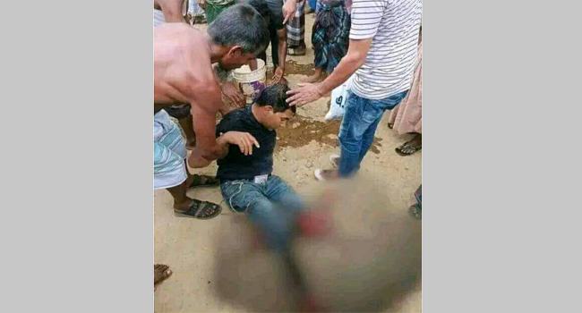 কমলগঞ্জে ট্রেনে উঠতে গিয়ে পা হারাল যুবক