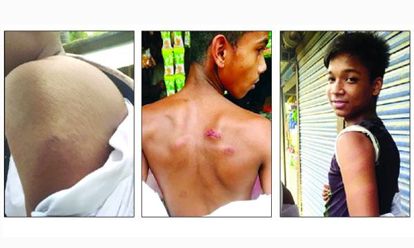 শিক্ষার্থীদের পিটিয়ে রক্তাক্ত করলেন প্রধান শিক্ষক