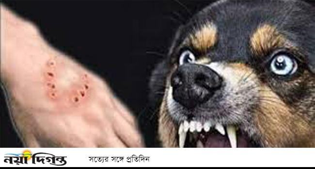 শৈলকুপায় পাগলা কুকুরের কামড়ে ২ শিশুসহ ১৪ জন আহত