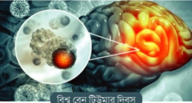 দেশেই ব্রেন টিউমারের চিকিৎসা হয়
