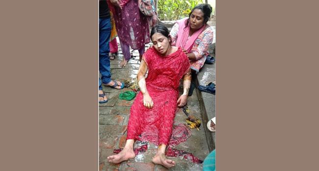 পটুয়াখালীতে আগুনে পুড়িয়ে গৃহবধূ ও শিশু হত্যার চেষ্টা
