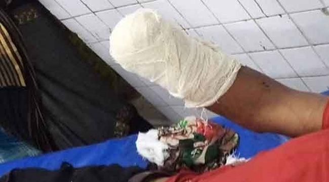 ইউটিউব দেখে বোমা বানাতে গিয়ে হাতের কবজি হারালো যুবক, গ্রেফতার ১