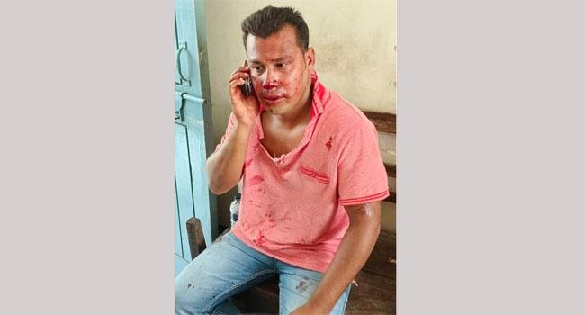 পাথরঘাটায় ছাত্রদল নেতাকে পিটিয়ে জখম