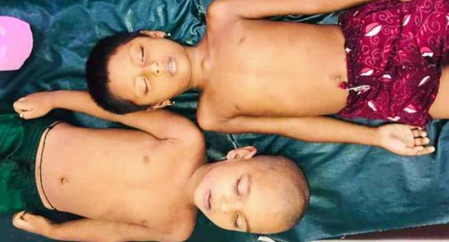 ডুমুরিয়ায় পানিতে ডুবে ২ শিশুর মৃত্যু