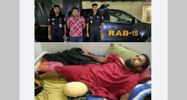 রামুতে দায়ের কোপে ছোট ভাইয়ের পা বিচ্ছিন্ন, গ্রেফতার বড় ভাই