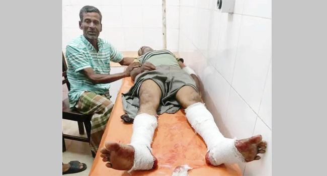 সাঁথিয়ায় সাবেক চেয়ারম্যানকে পিটিয়ে আহত, আটক ১৩