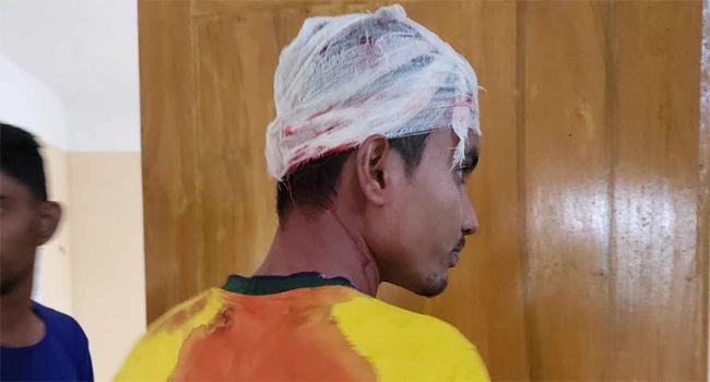 কাউখালীতে পর্যটককে পিটিয়ে জখম করলেন আ’লীগ নেতা