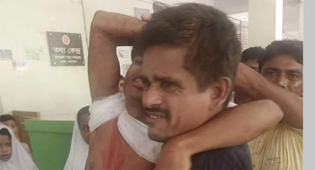 পেকুয়ায় ইউপি সদস্যের নেতৃত্বে গ্রামবাসীর ওপর হামলা, আহত ১৪