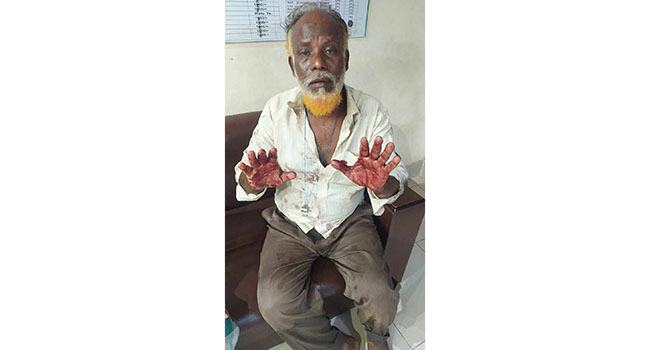 সিদ্ধিরগঞ্জে রি-রোলিং মিলে ডাকাতি, নৈশ প্রহরীকে কুপিয়ে জখম