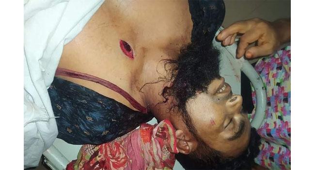 বিরামপুরে সালিশে প্রতিপক্ষের ছুরিকাঘাতে যুবক নিহত, আহত ২