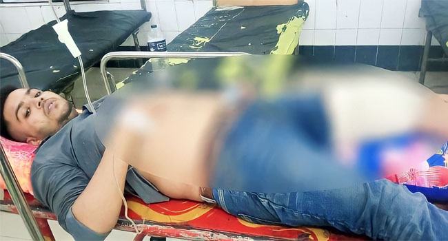 আশুলিয়ায় গভীর রাতে বাসায় ফেরার পথে যুবককে গুলি
