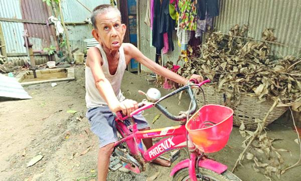 বিরল রোগে আক্রান্ত ১০ বছরের শিশু যেন ৬০ বছরের বৃদ্ধ