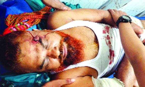 লালপুরে যুবদল নেতাকে ডিবি পরিচয়ে তুলে নিয়ে কুপিয়ে জখম
