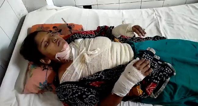 নোয়াখালীতে গৃহবধূর শরীরে কেরোসিন ঢেলে পুড়িয়ে হত্যাচেষ্টার অভিযোগ