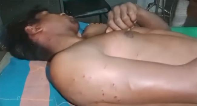 ভূরুঙ্গামারী সীমান্তে বিএসএফের গুলিতে এক বাংলাদেশী আহত