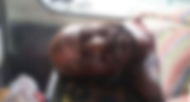 লালমোহনে বোমা তৈরির সময় বিস্ফোরণ, নিহত ১