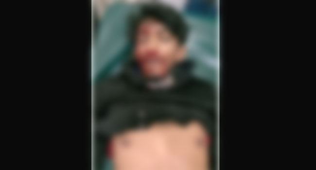 চৌগাছায় সড়ক দুর্ঘটনায় কলেজছাত্র নিহত