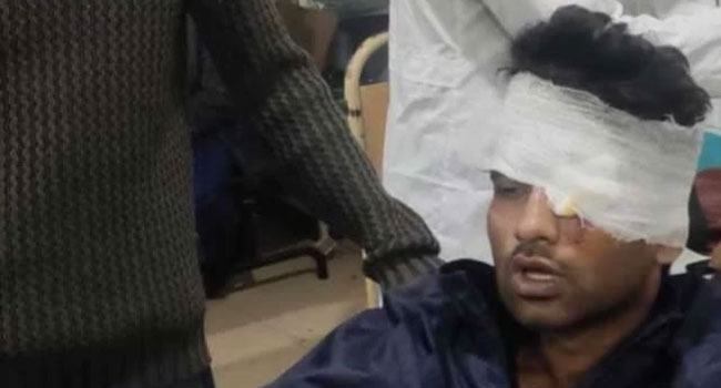 ঢাবি ছাত্রলীগের হামলায় ছাত্র ইউনিয়নের ৪ সদস্য আহত