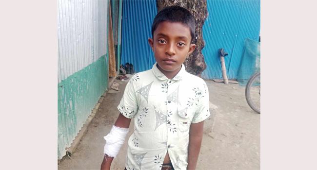 মিরসরাইয়ে কুকুরের কামড়ে নারী-শিশুসহ আহত ১০