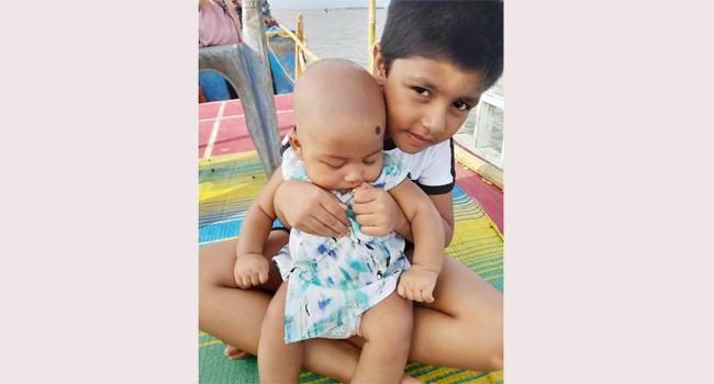 মায়ের সাথে অগ্নিদগ্ধ শিশু জাফরার মৃত্যুর ৪ দিন পর ছোট ভাইয়ের মৃত্যু