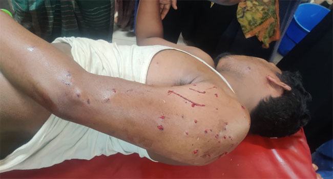নোয়াখালীতে অটোরিকশা চালককে গুলি