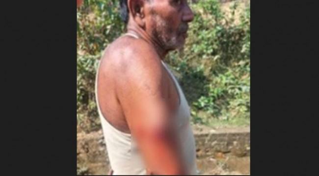 মিয়ানমারের ছোড়া গুলিতে বাংলাদেশী আহত