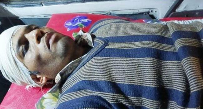 ঝালকাঠিতে পিস্তল ঠেকিয়ে শিক্ষককে হাতুড়ি পেটার অভিযোগ