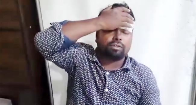 মিয়ানমার থেকে ছোড়া গোলায় আরো একজন বাংলাদেশী আহত